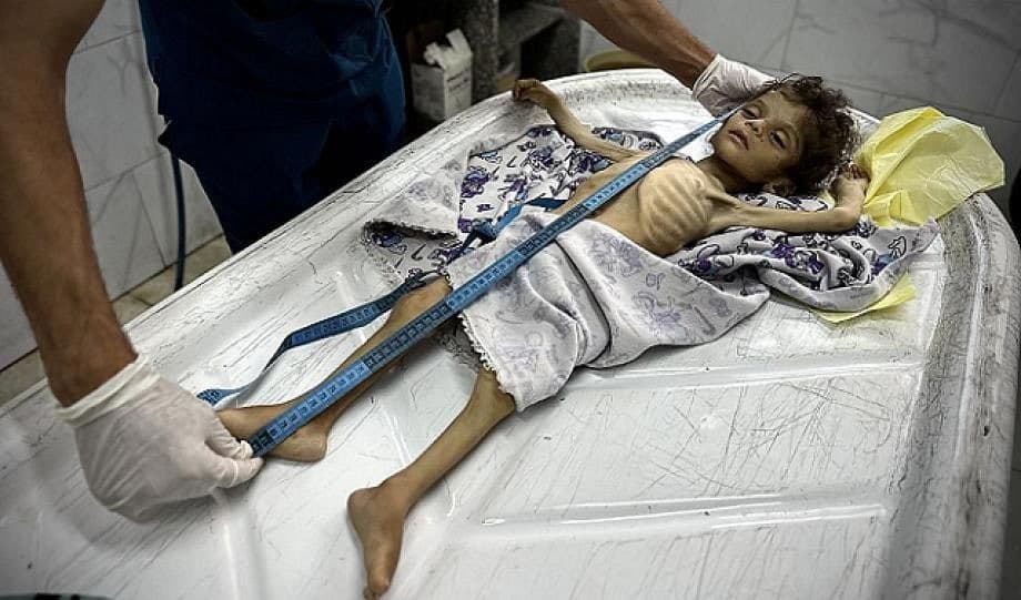 Famine In Gaza: Ongoing